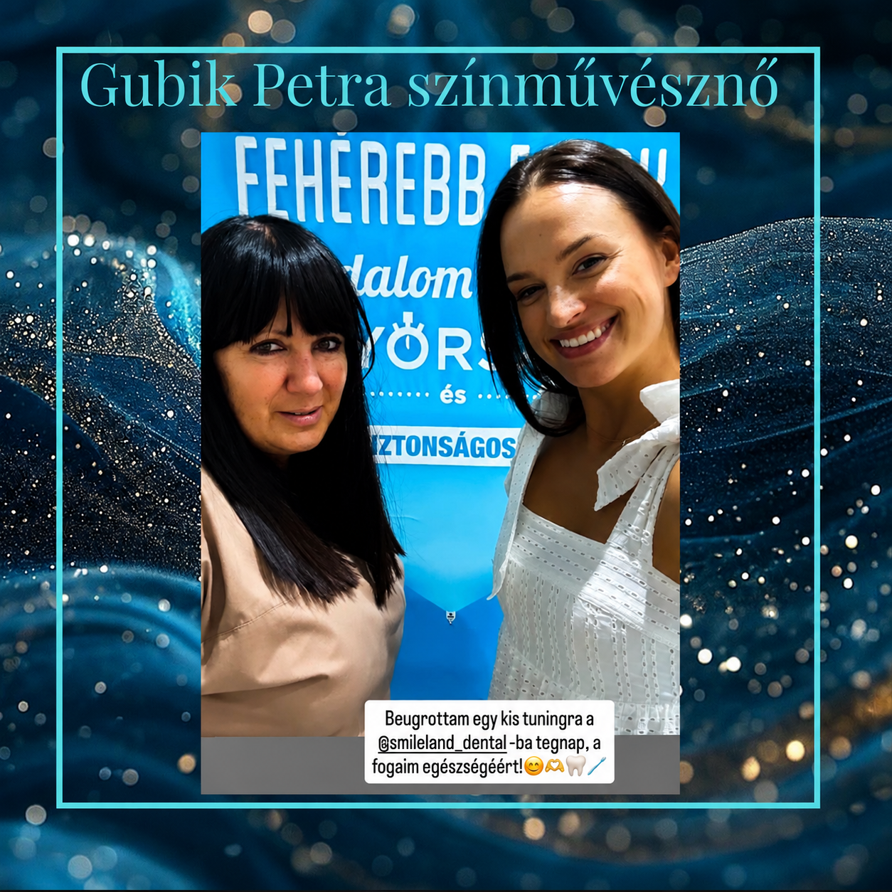 Gubik Petra Jászai Mari-díjas színművésznő bio fogfehérítés után a Smileland Dentalban Kecskeméten