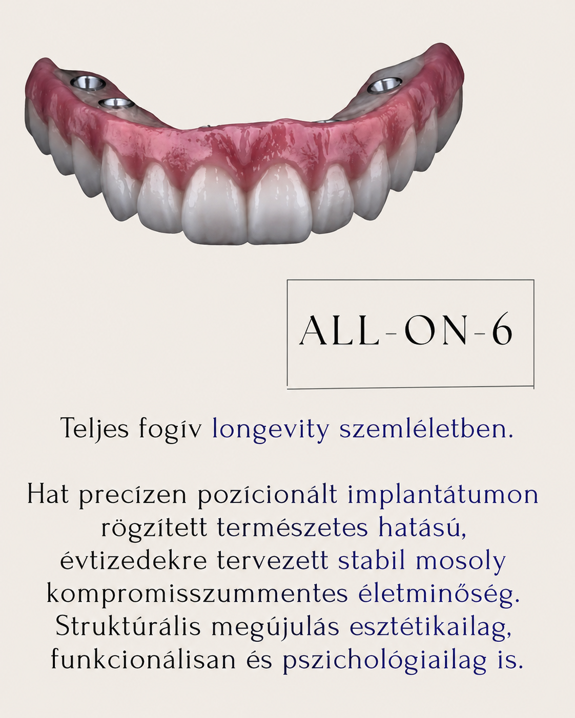 All-on-6 implantátumra épített teljes fogív – rögzített, esztétikus fogpótlás a Smileland Dentalnál